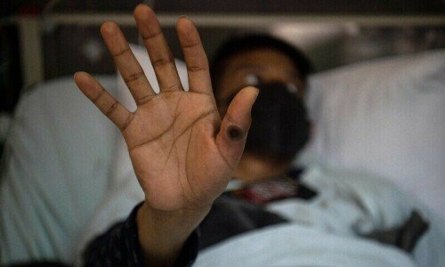 First mpox case of 2025 reported in Peshawar
