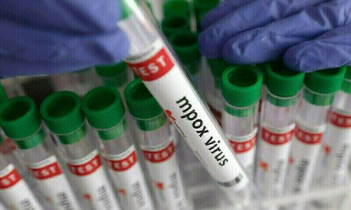 Sindh reports first case of mpox: health ministry