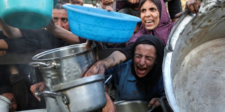 4-year-old Razan dies from malnutrition in Gaza: hospital source